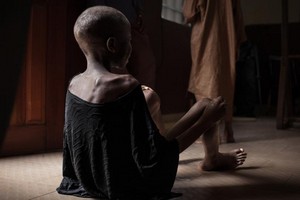 La faim poursuit sa progression dans le monde